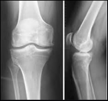 radiologia convenzionale per intervento protesi di ginocchio